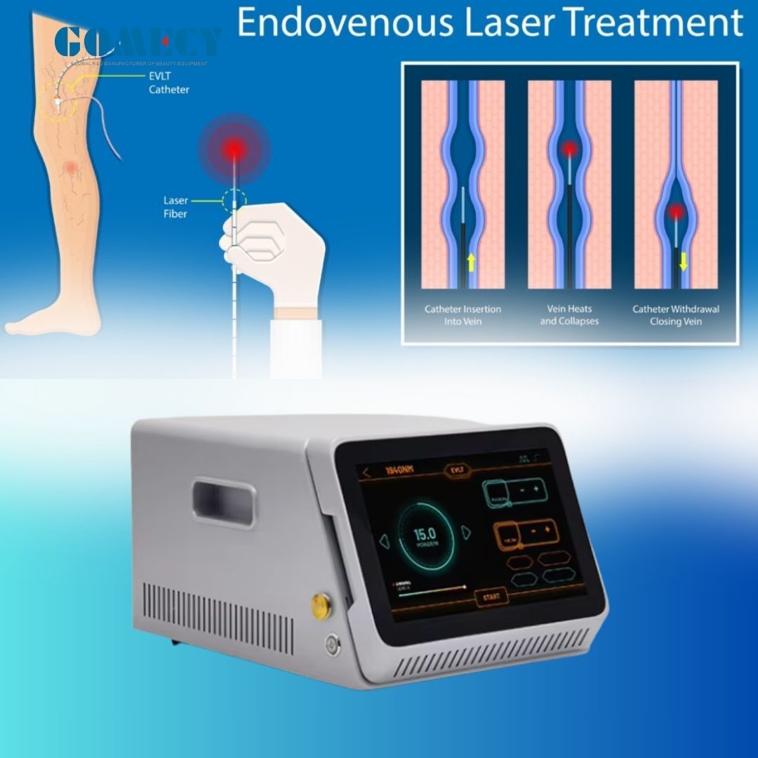 1940nm Diode Vascular Treatment Laser Evlt Redness Spider Veins Removal Painless Surgery Clinic