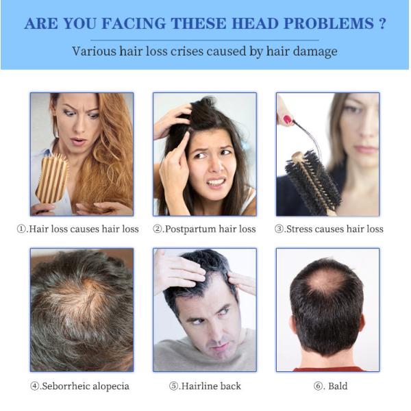 660nm Diode Laser Hair Growth Device For Hair Regeneration / Scalp Nourishment