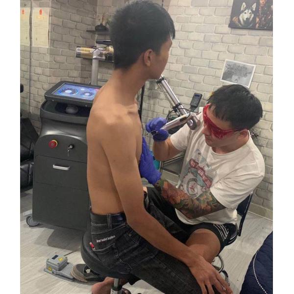 Máquina de eliminación de tatuajes sin dolor Q Switch Máquina de eliminación de tatuajes profesional 532nm