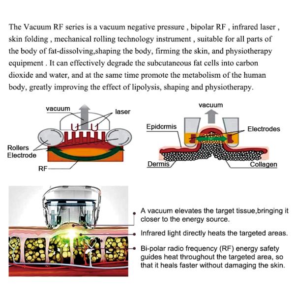 Vacuum Anti Cellulite RF Weight Loss Equipment Slimming Machine Weight Loss