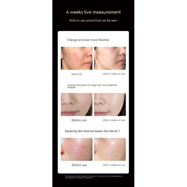 Hight Quality Medical Beauty Led Mask with Led Light Therapy Face Mask Infrared Led Mask Silicone