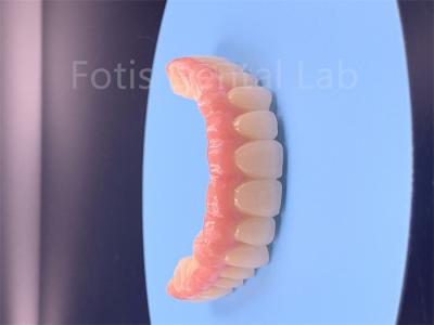 High Strength Zirconia Multilayer Product For Superior Performance