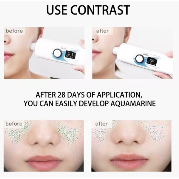 Hyaluronic кисловочная сыворотка концентрата сыворотки стороны сути разводя водой