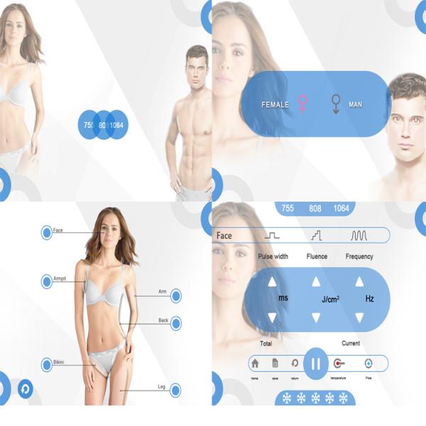 Nubway 755nm alex laser 808nm 1064nm triple wavelength diode laser machine for hair removal