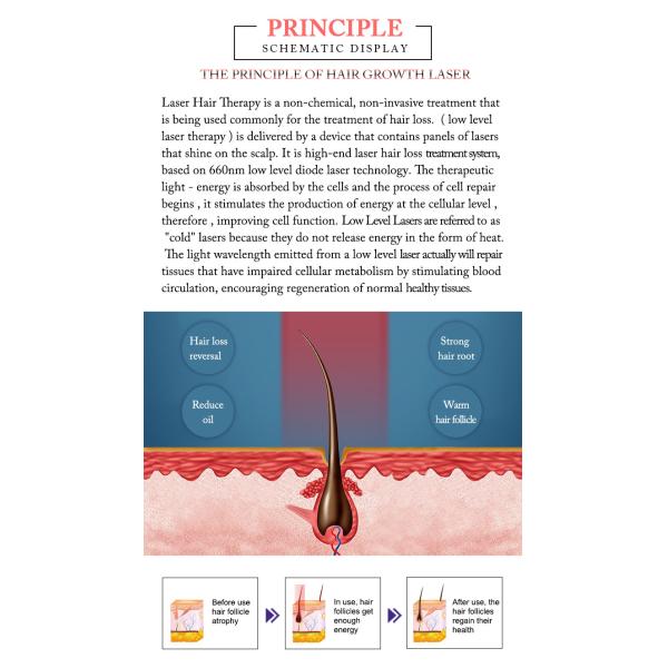 Machine de croissance des cheveux à diode laser de 660 nm, machine de traitement de la perte de cheveux.