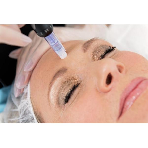 Dr. électrique meso professionnel Pen Derma de traitement de perte des cheveux de stylo de Microneedle