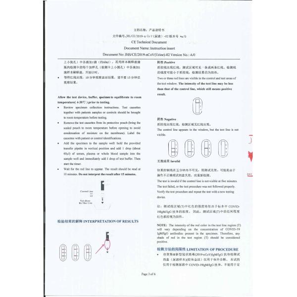 Novel coronavirus antibody (IgG/IgM) rapid urine assay by colloidal gold immunoassay strip