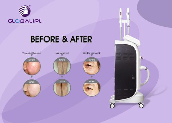 Permanent Hair Removal IPL RF Beauty Equipment With User Friendly Software