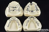 Cadre dentaire amovible pour s'adapter à la bouche pour soutenir la mastication