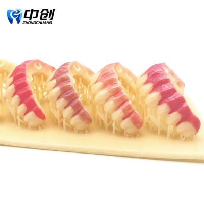 Kit de sombreamento de goma de 4 peças para obter um efeito de restauração natural com boa retenção de brilho
