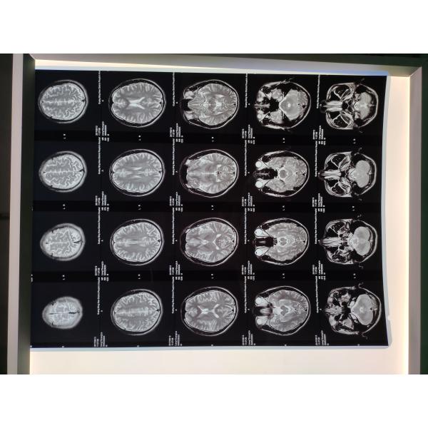 class I Medical Dry Thermal Sensitive Film for Inkjet Printer