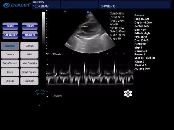 GH-L5 Portable Ultrasound Machine  4d Diagnostic Ultrasound Pregnancy Machine
