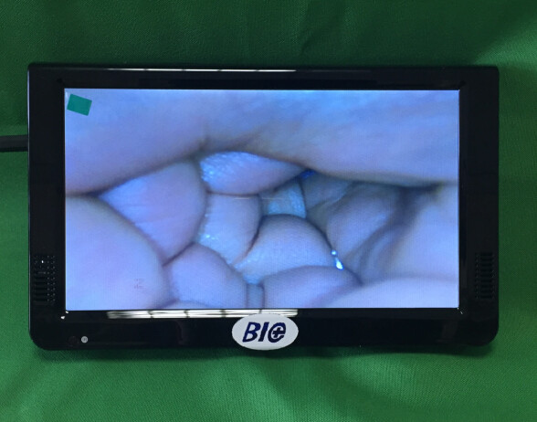 X Colposcope électronique de Digital de 1,5 rapports optiques se relient à la TV ou l'ordinateur ou le moniteur médical santé de s pour femmes '