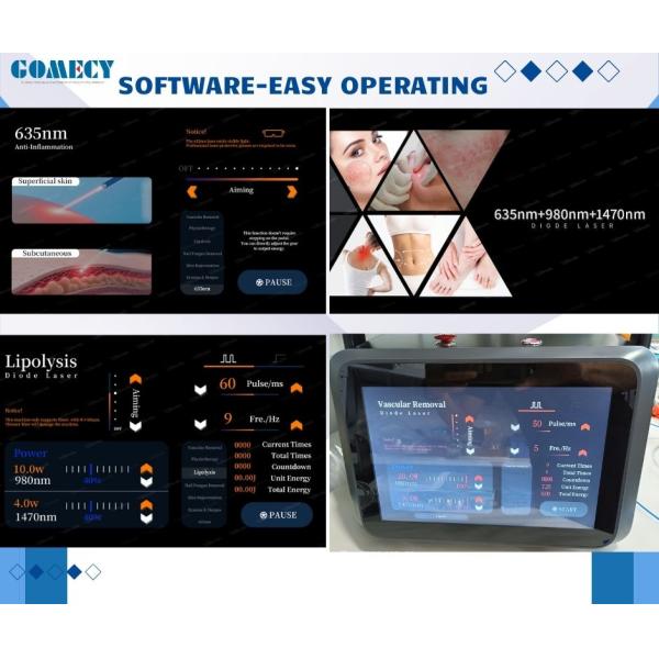 Endo Face Lifting Lipolysis Laser Liposuction Body Slimming Machine Diode 635 980 1470nm Endolaser Laser Equipment