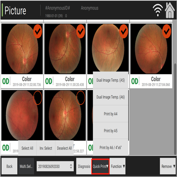 Ручная томография сцепления офтальмологии камеры Fundus цифров