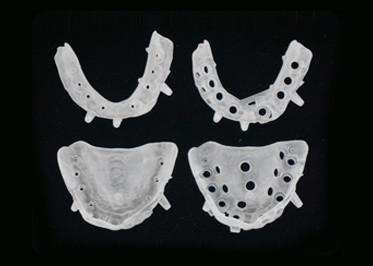 Impressão 3D de alta precisão