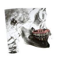 Les appareils orthodontiques fixes en caoutchouc adaptés aux besoins du client faciles maintiennent