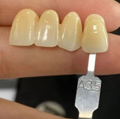 Собственная личность покрасила Pre затеняемый Zirconia 3D блока Zirconia разнослоистый прикрывает зубоврачебное