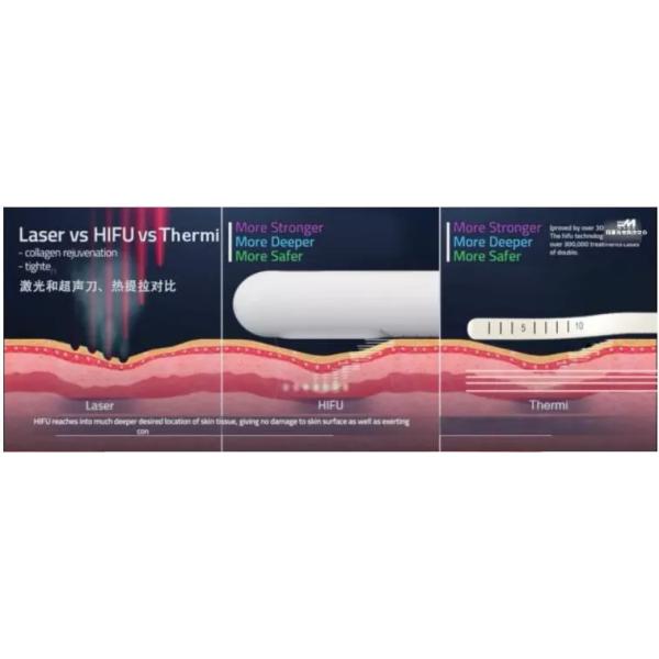 2 In 1 RF Beauty Machine for female intimate areal Tighten Labia Tighten Vulva Rejuvenation and Beauty