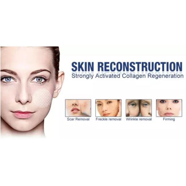 40W RF Tube Co2 Fractional Laser Equipment With Vaginal Tightening Machine 10600nm