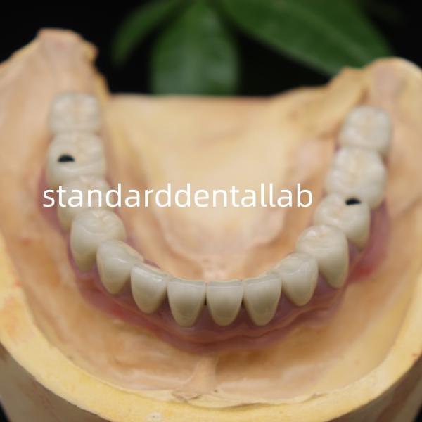 Скрутные зубные имплантаты металлические керамические короны Мост Мало