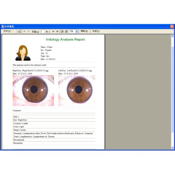 Digital eye iriscope iridology camera iris scanner/ hair scanner/ skin scanner