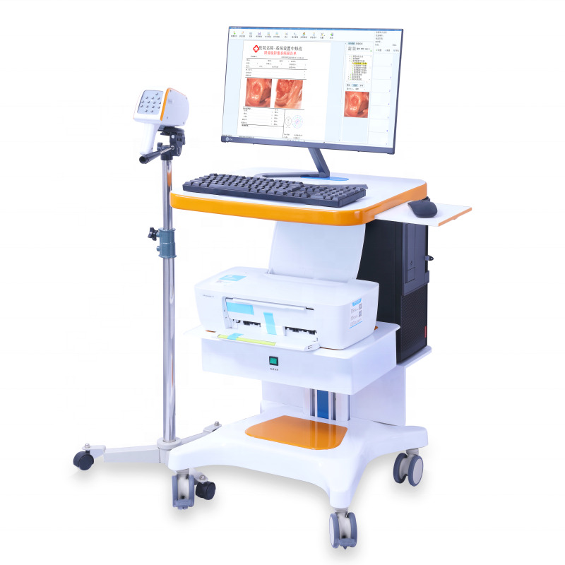 Portable GYN Colposcope Full Hd Sony Camera Digital Video Colposcope Imaging System Examination Colposcope For Gynecology