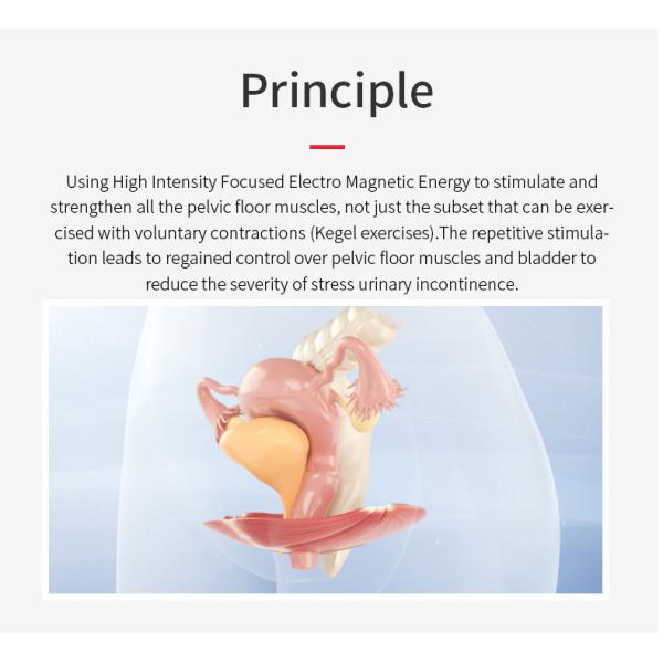 EMS Pelvic Chair Pelvic Floor Muscle Strenthening High-Intensity Focused Electromagnetic Urinary Incontinence Treatment