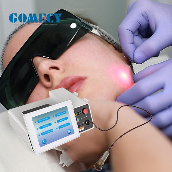 Не-хирургический самый лучший лазер обработки лицевой Endolifting1470nm Endolift стороны и стороны лазера подтяжки лица тела поднимаясь