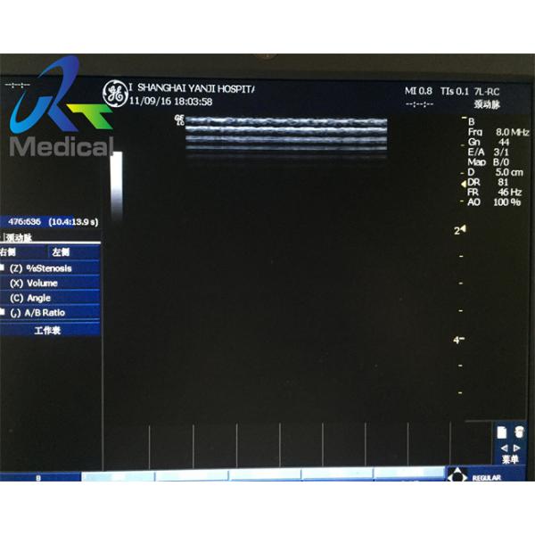 GE 7L-RC 12MHz Wide Band Linearx Used Ultrasound Probe Medical Hospital Instrument