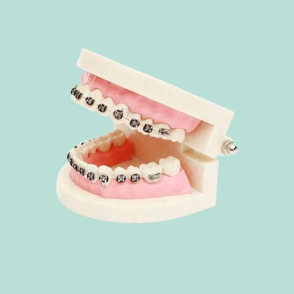 Сопротивление хорошее Biocompatibility кислоты и алкалиа кроны фарфора зубоврачебное