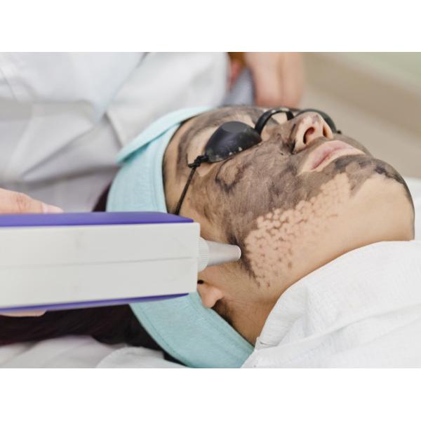 800w Pico Nd Yag Laser Tattoo Removal Machine Q - Switched Type For Beauty Salon