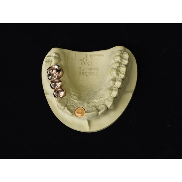 Audental A75 Noble Alloy HIGH NOBL Yellow Au75% for Crown Bridge Restorations