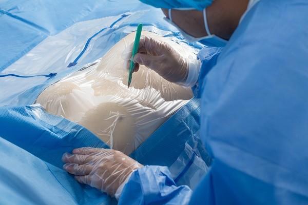 By-Pass Custom Surgical Packs , Wrapping Surgical Packs High Efficiency