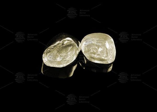 Sleek Full Cast Metal Crown Precious Alloy Gold 20% Polished Full Metal Dental Crown