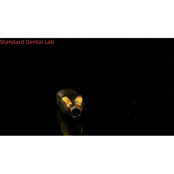 Pure Titanium Custom Abutments The Perfect Solution for Dental Restorations