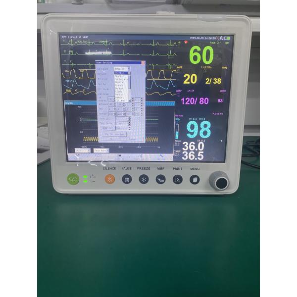 Монитор 12,1 дюймов оборудования больницы медицинский терпеливый с Multiparameters СО2