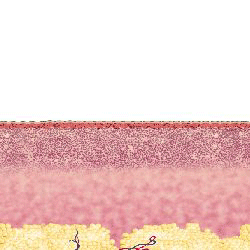 Hot sale scar removal stretch mark removal 10600nm Fractional Co2 laser machine