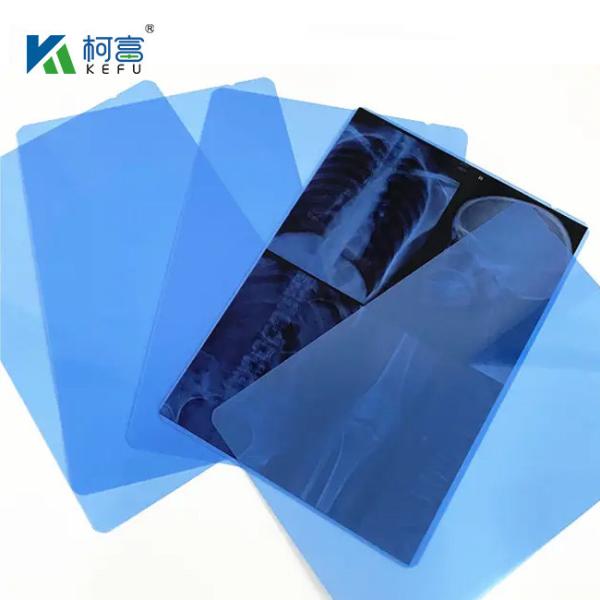 High Resolution Blue / White Medical Film For Hospital Printing Equipment