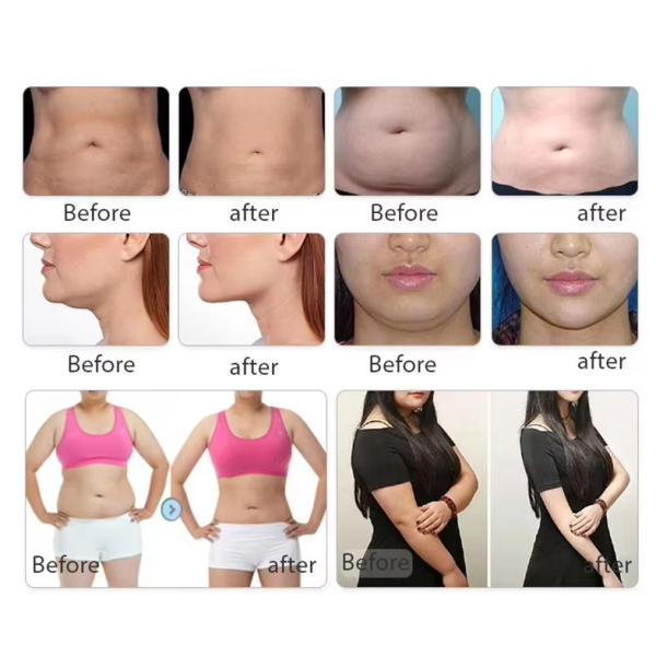 40K Cavitation Ultra Slimming Ems 2 In1 Body Sculpting 360 Cryo Machine