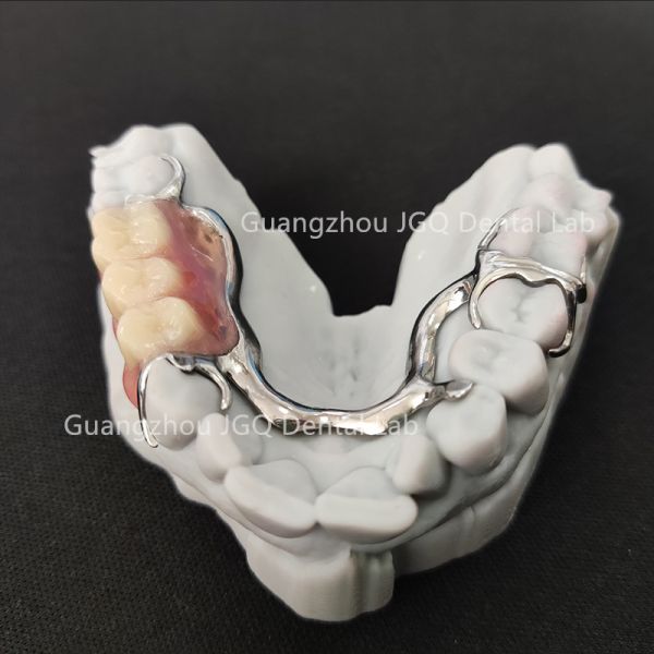 Lightweight Dental Framework Partial Dentures 3D Laser Printing Comfortable