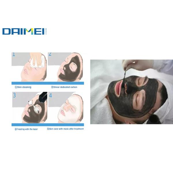 Portable Q Switched Nd Yag Laser Tattoo Removal Machine , Pigment Removal Machine