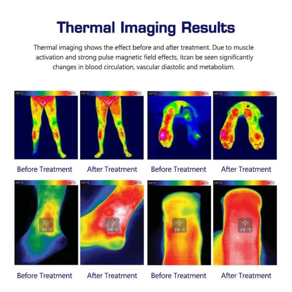 Machine de thérapie magnétique de bureau 1 Hz-100 Hz pour la réhabilitation du tendon d'Achille / ligament de la cheville
