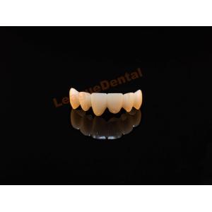 Full Zirconia