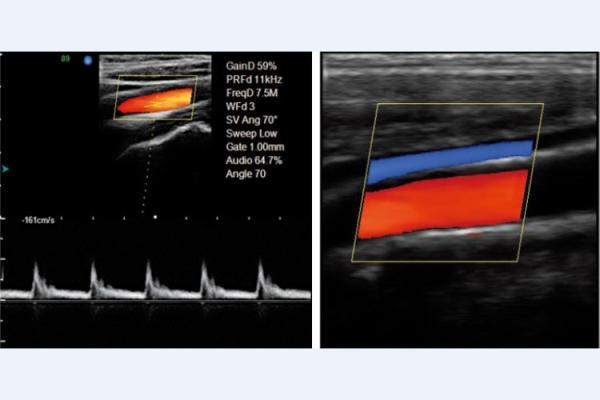 Mobile Medical Ultrasound Machine 3D Color Doppler Ultrasound