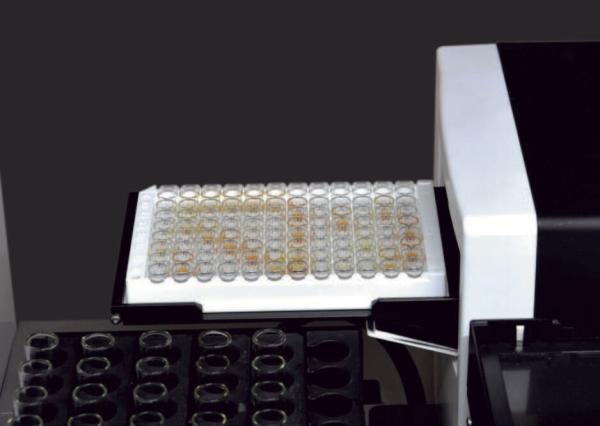 EL-6868 Automated ELISA Analyzer: Modular Automation Concept, Data Analysis & Statistics
