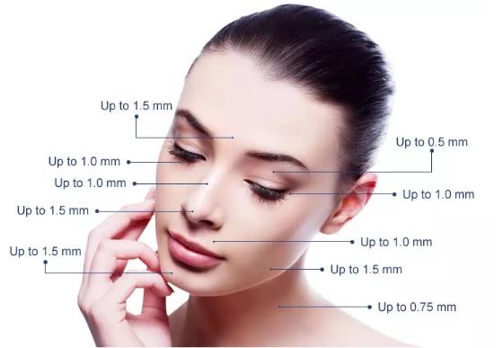 0.25mm 0.75mm 0.5mm 1.5mm 1.0mm Needles Size Blue Derma Roller Dermaroller 540