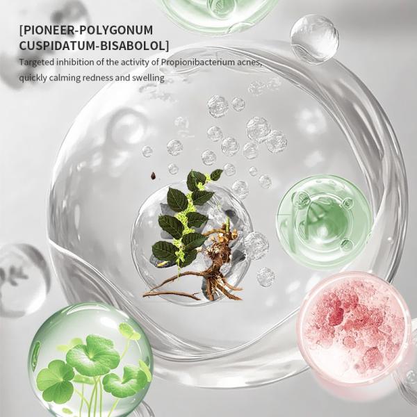 Ácido salicílico para limpiar las espinillas de la piel grasa y propensa al acné