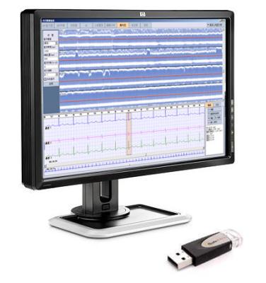 Holter ECG Analysis Software iTengo+ CE approved 99.9% accuracy ECG Waterfall technology