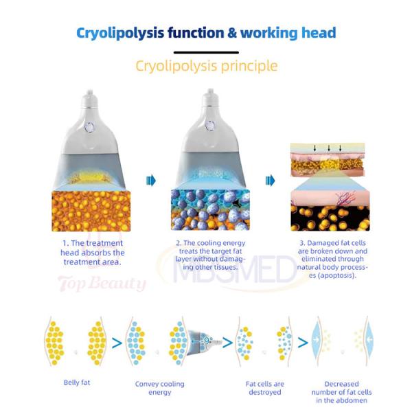 Newangie Nouvelle Arrivée Cryo 360 Cryolipolyse Élimination des Graisses Cryothérapie Machine Minceur Cryolipolyse